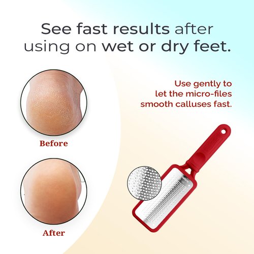 Microplane Colossal Foot File - Original Stainless Steel Callus Remover & Gentle Foot Scrubber | Red