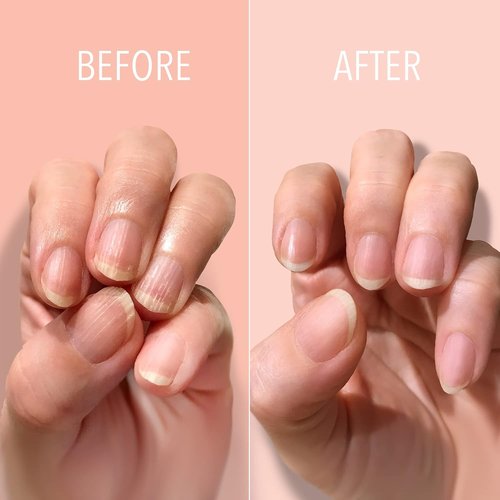 LONDONTOWN Kur Nail Ridge Filler - Strengthening & Smoothing Formula - Vegan, 0.4 fl oz