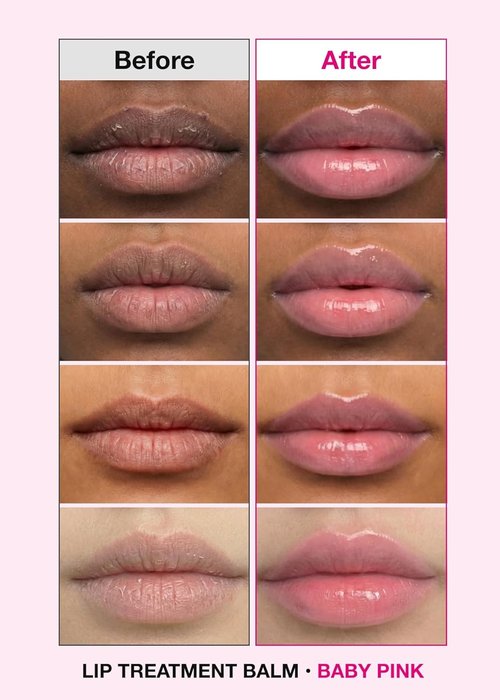 ISOI Bulgarian Rose Lip Treatment Balm - Hydrating Tinted Lip Balm for Dry Lips | Baby Pink (0.18 oz, 5g)