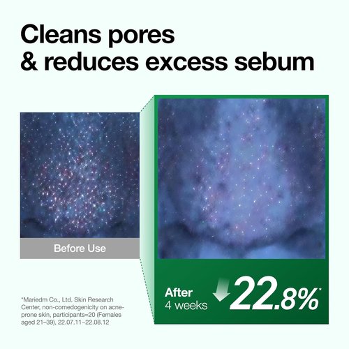 Anua Heartleaf Pore Control Cleansing Oil - Gentle Makeup Remover for All Skin Types | 6.76 fl. oz.