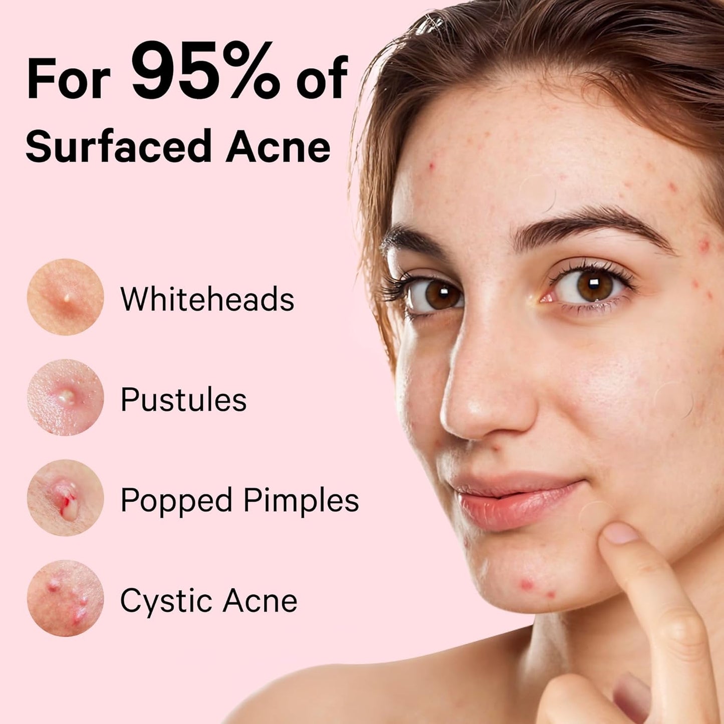 Sosky Pimple Patches - Invisible Hydrocolloid Acne Stickers with Salicylic Acid | 48 Count for Clear Skin