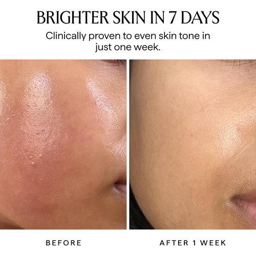 HERBIVORE Nova 15% Vitamin C + Turmeric Brightening Serum - Reduce Dark Spots & Hyperpigmentation | Vegan, 30 mL / 1 oz
