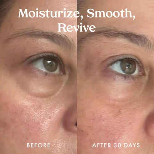 Kopari Ceramide & Retinol Eye Balm - Hydrating Anti-Aging Treatment for Fine Lines & Puffiness