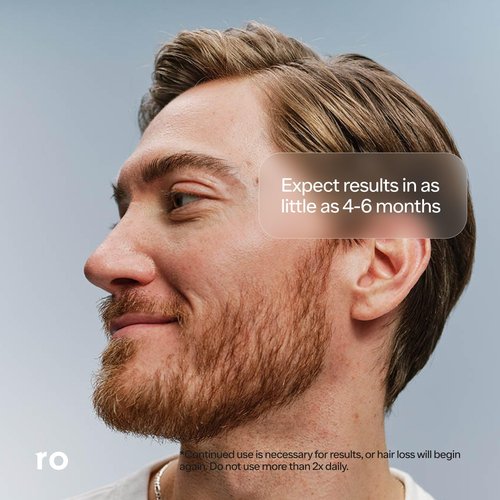 Roman Men's Topical Hair Regrowth Treatment Spray | 5% Minoxidil Solution, Clinically Proven for Thinning Hair, Easy to Use, Unscented | 3-Month Supply