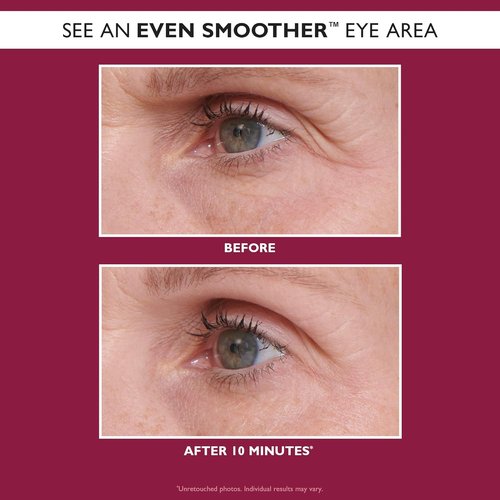 Peter Thomas Roth | Even Smoother™ Glycolic Retinol Eye Patches - Treat Fine Lines & Texture, 30 Patches