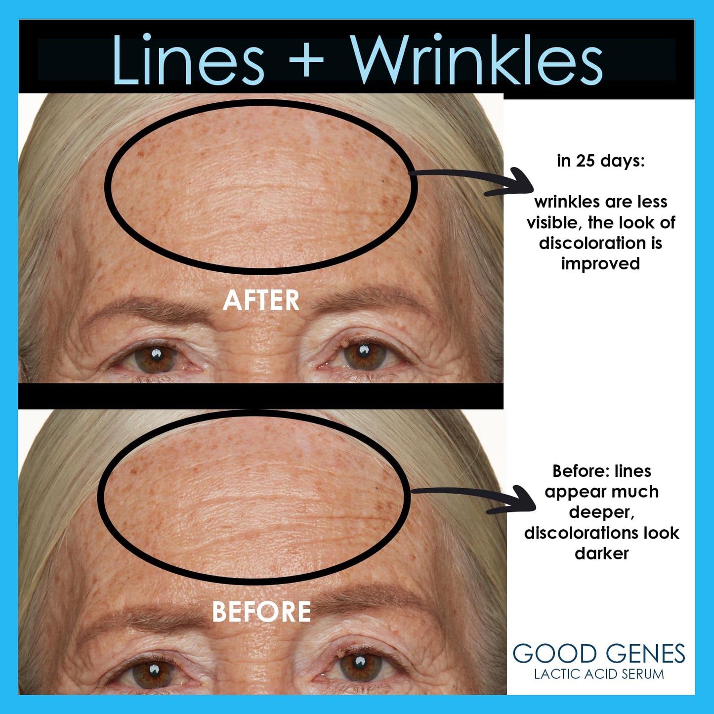 Sunday Riley Good Genes Lactic Acid Treatment - All-in-One Face Serum for Radiant Skin