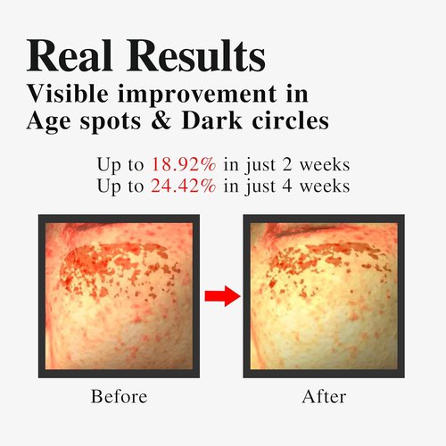 BARULAB Galvanic Dark Spot Serum - Auto Depuffing Eye Cream for Dark Circles & Uneven Skin Tone