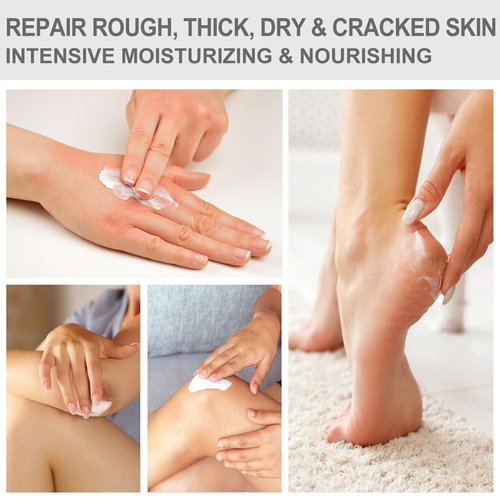 Mouriven Urea Cream 40 Percent - Foot & Hand Cream for Dry, Cracked Heels, Feet, Knees, Elbows, and Hands - Maximum Strength Urea Lotion for Softening and Moisturizing