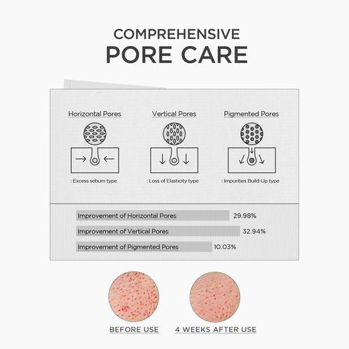 SKIN1004 Niacinamide 10% Boosting Shot Ampoule, Niacinamide Spicule Serum for Face, Facial Ampoule with Tranexamic Acid, Pore Minimizer for Face, Madagascar Centella, Korean Skin Care, 1.01fl.oz/ 30ml