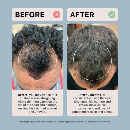 ACTIIV Recover Travel Duo For Men - Plant-Based Hair Care for Fuller, Healthier-Looking Hair | Color-Safe & Vegan
