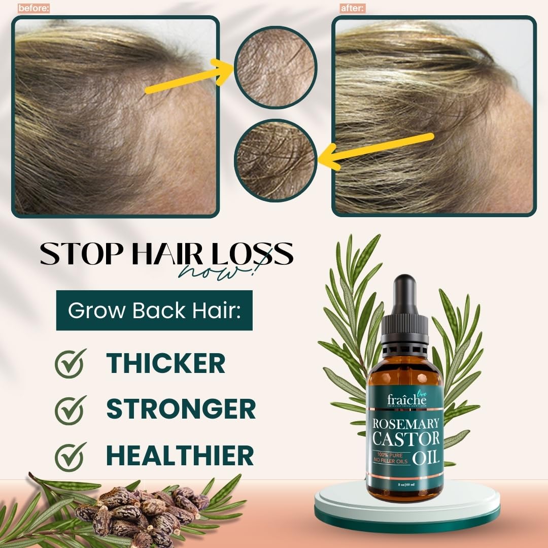 Live Fraiche Rosemary Castor Oil for Hair Growth 16oz - Rosemary Oil for Hair Growth and Thickening Pure Blend to Reduce Loss and Promote a Healthy Scalp