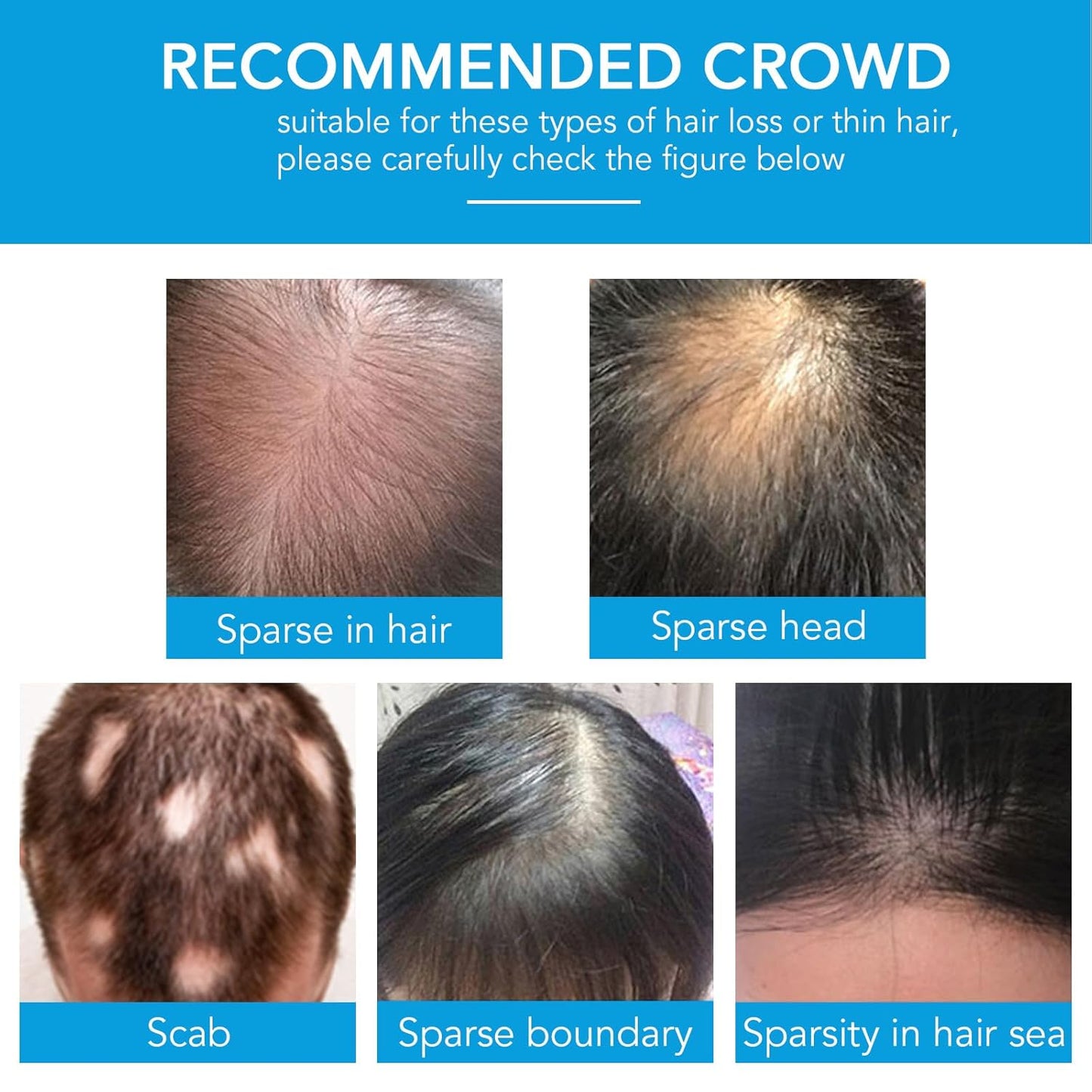 Hair Building Fibers with Spray, Hair Thickening Fibers for Thinning Hair & Bald Spots Thicker Fuller Hair in 15 Seconds Suitbable for Man and Woman 0.97Oz(Dark Brown)