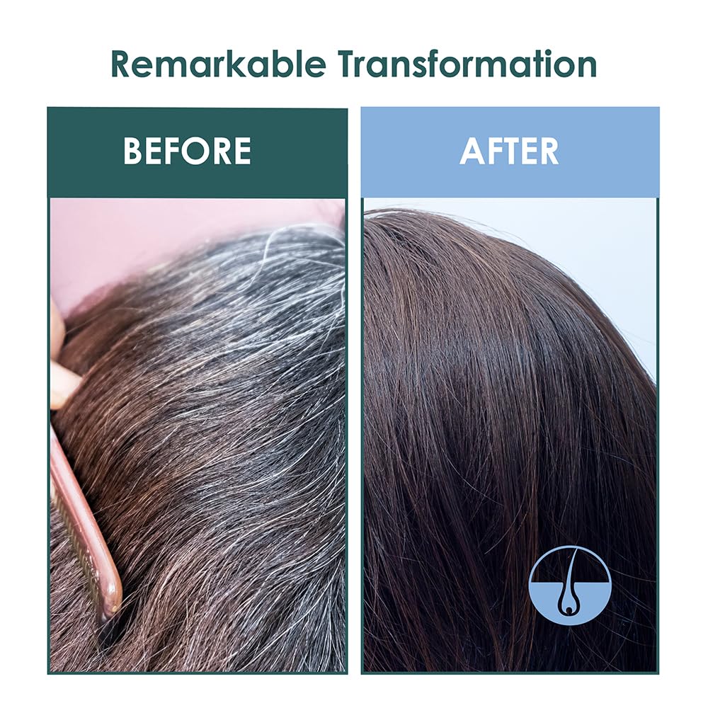 SH-RD Intensive Scalp Essence - Anti-Aging Hair Growth Serum with Amino Acids & Vitamin B5 | 50ml/1.69oz