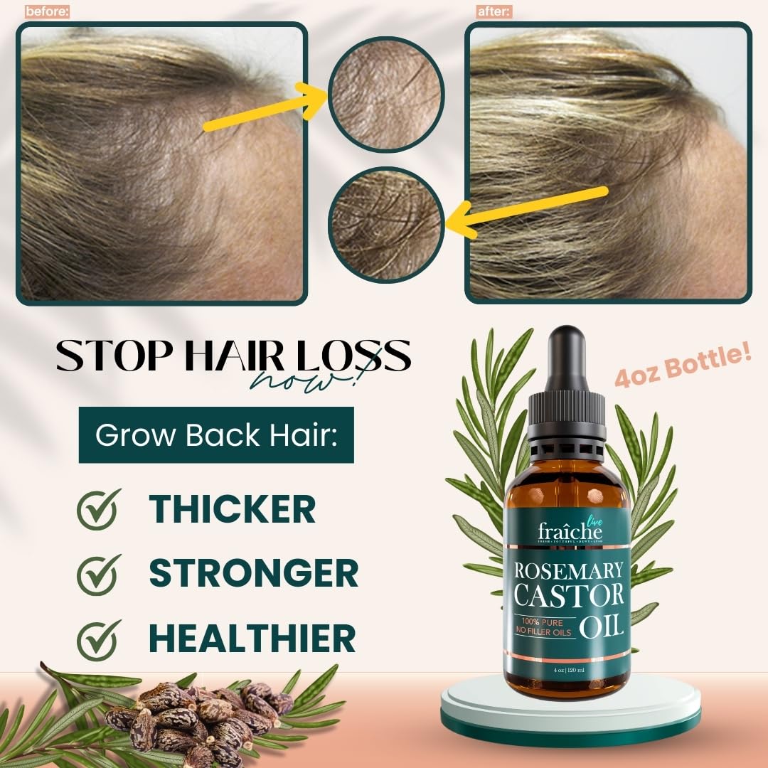 Live Fraiche Rosemary Castor Oil for Hair Growth 16oz - Rosemary Oil for Hair Growth and Thickening Pure Blend to Reduce Loss and Promote a Healthy Scalp