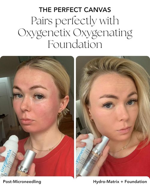 Oxygenetix Oxygenating Hydro-Matrix | Lightweight Aloe-Based Moisturizer with Hyaluronic Acid for Sensitive Skin (2.54oz)