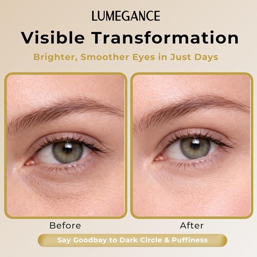 Lumegance Daily Renew Eye Cream - 5% Niacinamide & 5-Peptide Complex for Dark Circles | 30ml Hydrating Formula
