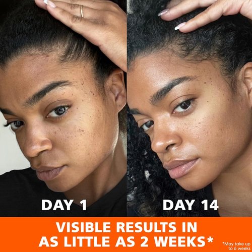 Palmer's Skin Success Anti-Dark Spot Fade Cream - Vitamin E & Niacinamide, 2.7 Oz for All Skin Types