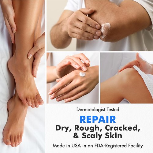 Ebanel Professional Callus Remover Set - Urea Cream 40% & Salicylic Acid 2% for Soft Feet | Exfoliating Gel