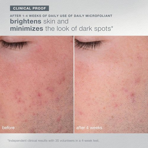 Dermalogica Travel-Sized Skin Care Set - Exfoliants, Serum & SPF Moisturizer for Radiant Skin