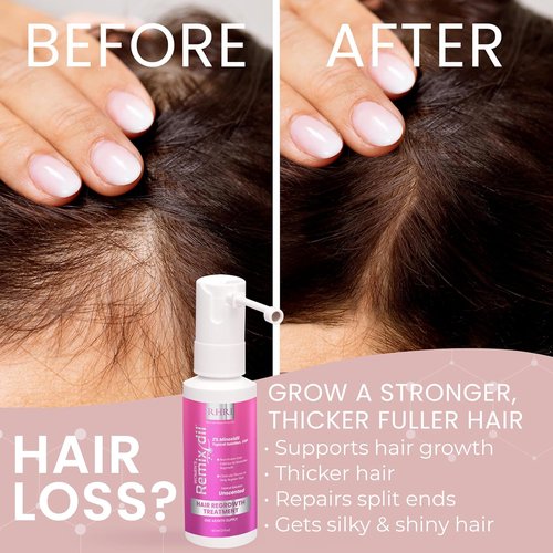 Minoxidil 2% Hair Regrowth Spray for Women | Thicker, Fuller Hair - Clinically Proven Formula - 60 ml