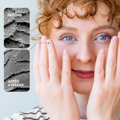 NakeyNails Fast-Absorbing Nail Strengthener | Revitalize Weak, Thin & Post-Acrylic Nails - 45 Day Supply