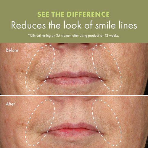 Origins Plantscription Lifting & Firming Peptide Moisturizer - Anti-Aging Face Cream for Smooth Skin