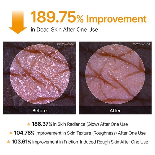 Dr. Melaxin Body Keratin Care Spray - Kojic Acid & Turmeric Exfoliating Solution | 6.76 fl. oz.