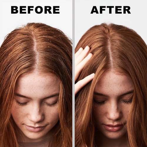 Regine Switzerland Dry Shampoo Spray - Volumizing Formula with Rice Starch for Light Tones