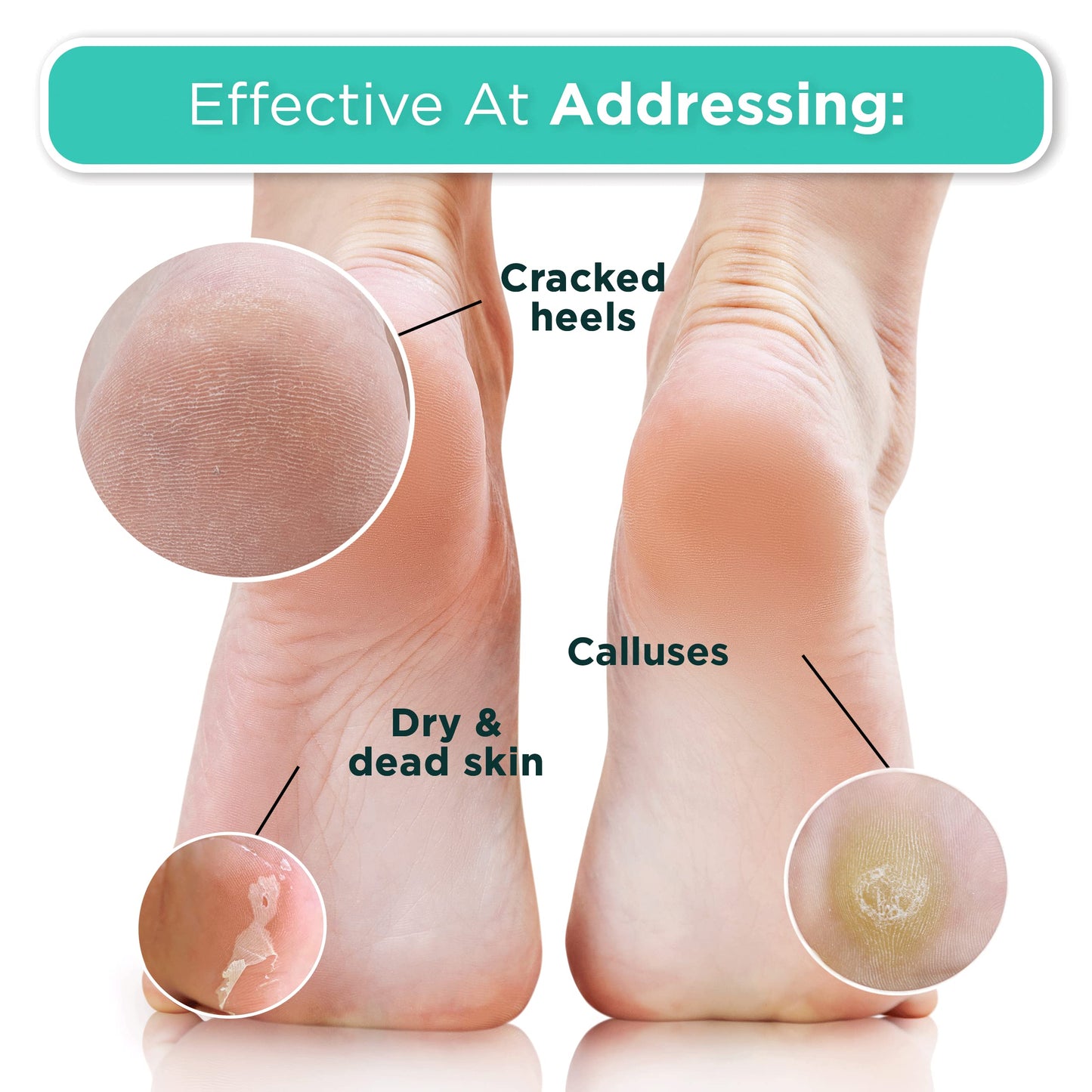 DERMORA Foot Peel Mask - 2 Pack of Large Size Skin Exfoliating Foot Masks for Dry, Cracked Feet, Callus, Dead Skin Remover - Feet Peeling Mask for baby soft feet, Original Scent