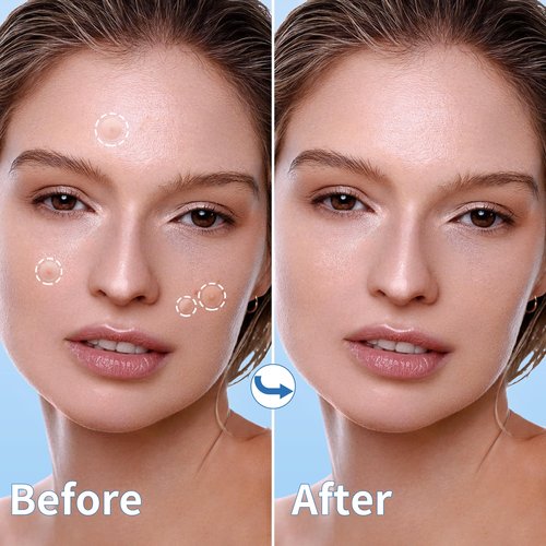 Daolyo Pimple Patches for Face - 3 Size 510 Counts Hydrocolloid Acne Patches for Covering Zits and Blemishes, Spot Stickers with Salicylic Acid, Tea Tree Oil & Calendula Oil(8mm,10mm,12mm)
