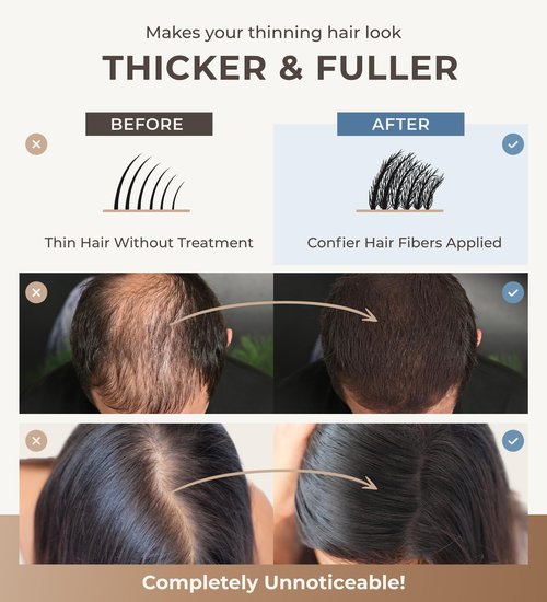 CONFIERR Keratin Hair Fibers for Men & Women - Fill In Fine or Thinning Hair, Instantly Thicker, Fuller Looking Hair (Gray 15g)