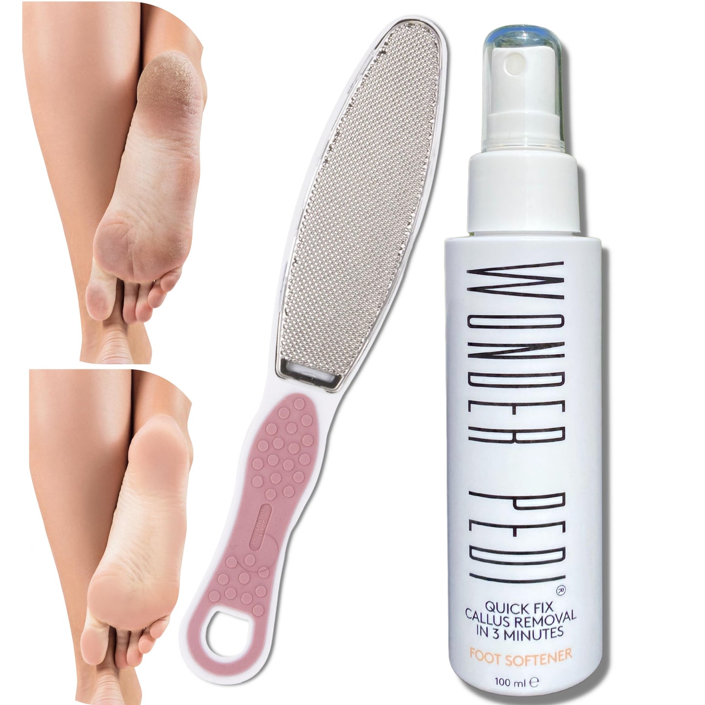 Made in Germany Double-Sided Metal and Emery Foot File - Heel Scraper & Cracked Feet Repair Instant Exfoliating Peel Foot Spray - Dead Skin Remover Cracked Heels Softener. Wonder Pedi