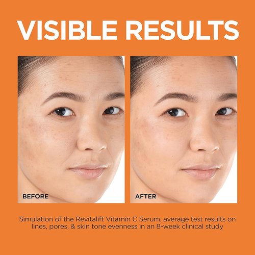 L'Oreal Paris Revitalift 12% Pure Vitamin C Serum - Brightening Face Serum with Vitamin E & Salicylic Acid, 1 oz