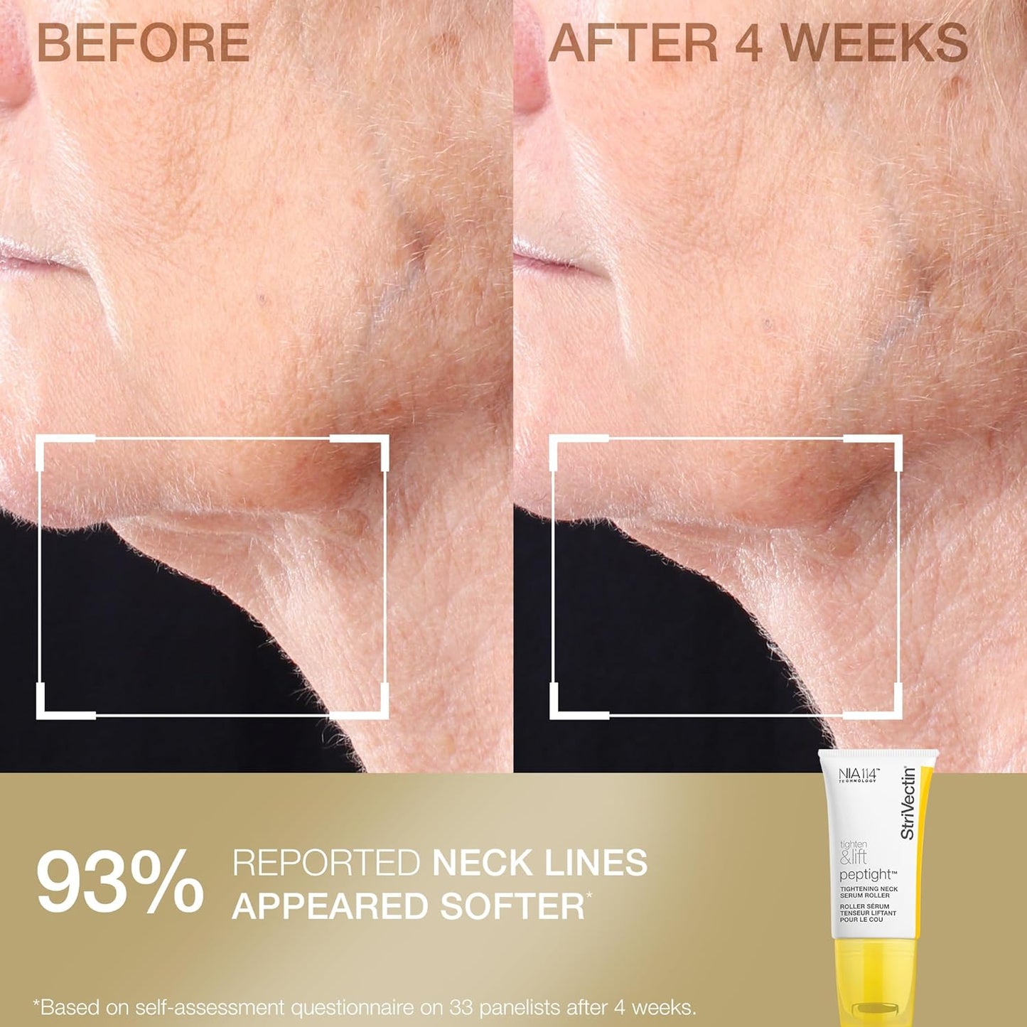 StriVectin Neck Cream & Serum Roller Set - Anti-Aging Formula for Smoother Skin & Reduced Wrinkles