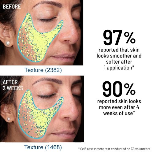 Dr. Brandt Advanced Microdermabrasion Face Exfoliator - Refines Texture & Minimizes Fine Lines - 2 oz