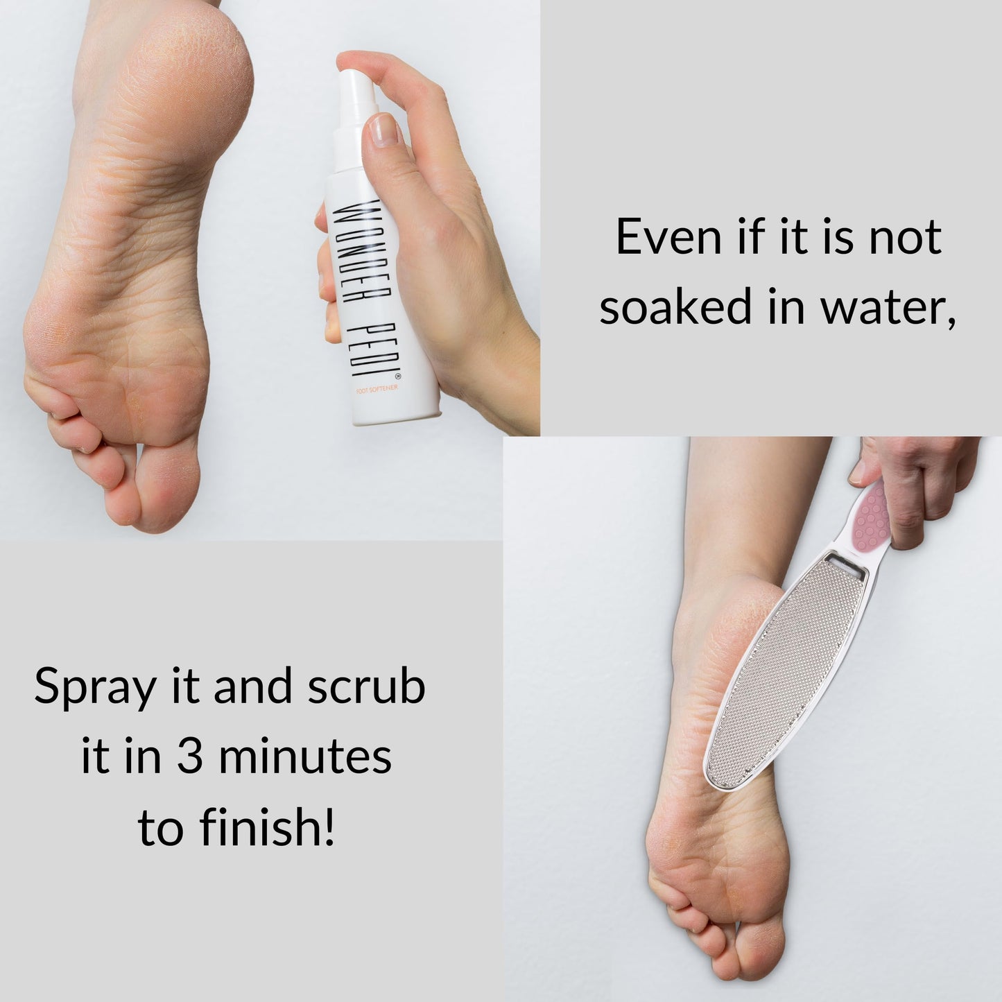 Made in Germany Double-Sided Metal and Emery Foot File - Heel Scraper & Cracked Feet Repair Instant Exfoliating Peel Foot Spray - Dead Skin Remover Cracked Heels Softener. Wonder Pedi