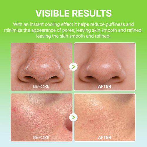 Dr. Melaxin Cactox Pore Relief Balm Stick - Cooling & De-Puffing Formula with Zinc PCA & Cactus Extract, 0.88 oz