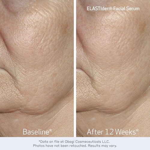 Obagi Travel Skincare Set - Anti-Aging Essentials for All Skin Types | Includes Cleanser, Toner & Serums