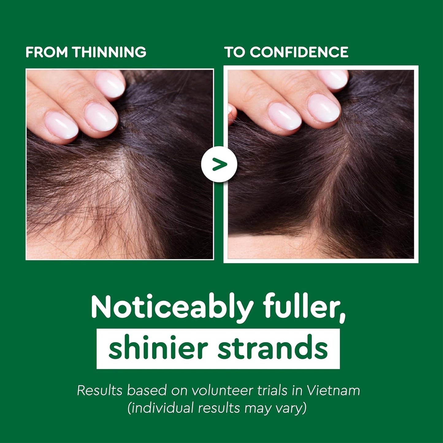 VIETNAM Hair Growth Shampoo - Strengthens Thinning Hair with Polygonum Multiflorum | 14.8 oz