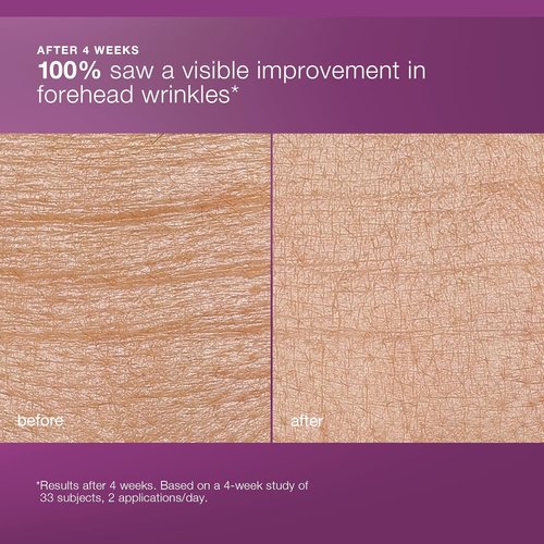 Dermalogica MultiVitamin Power Recovery Face Cream, Hydrating Facial Moisturizer with Antioxidants - Preventing Signs of Skin Aging, 1.7 fl oz
