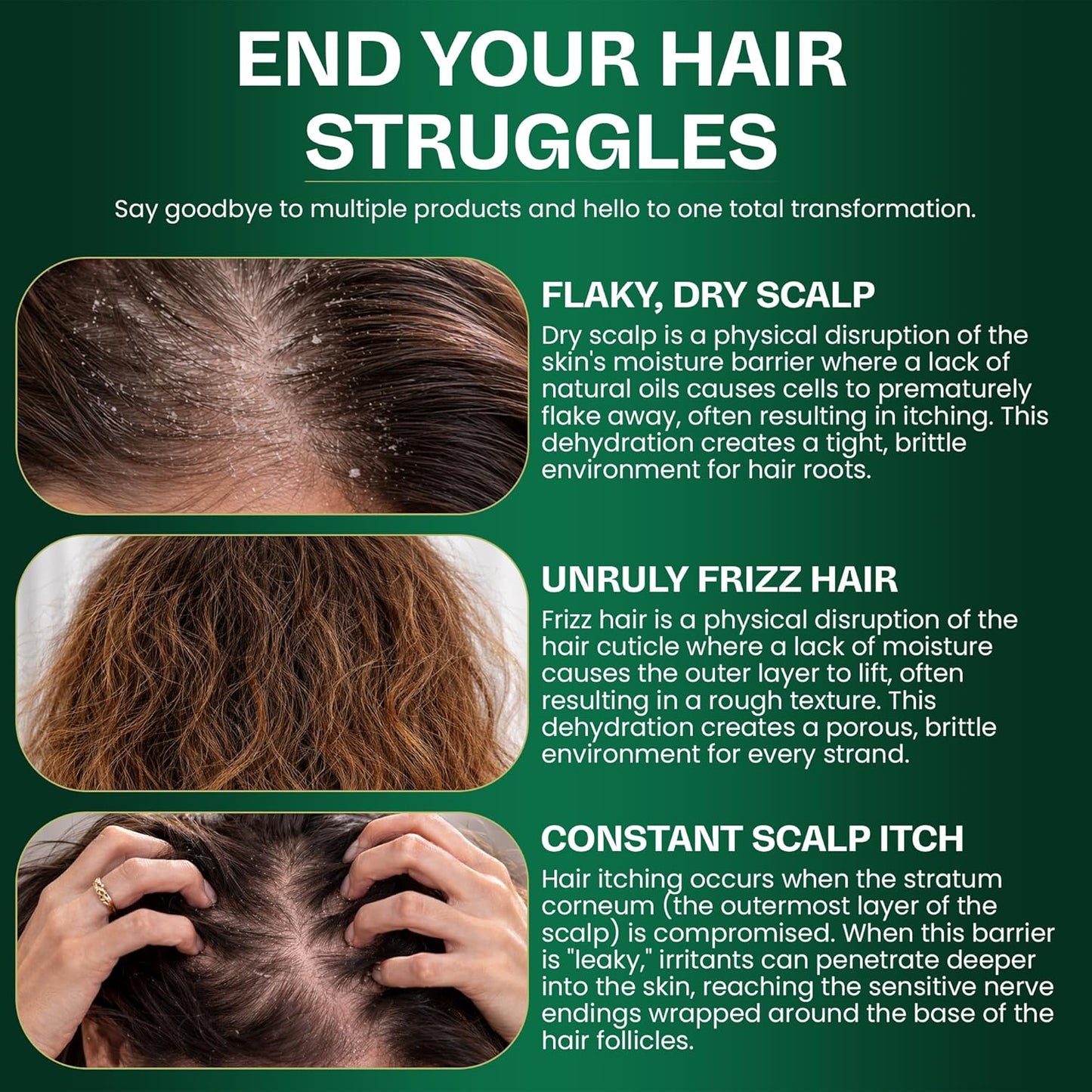 Tea Tree Shampoo & Conditioner Set - Thinning Hair Treatment for Men & Women | Soothes Itchy Scalp & Dandruff