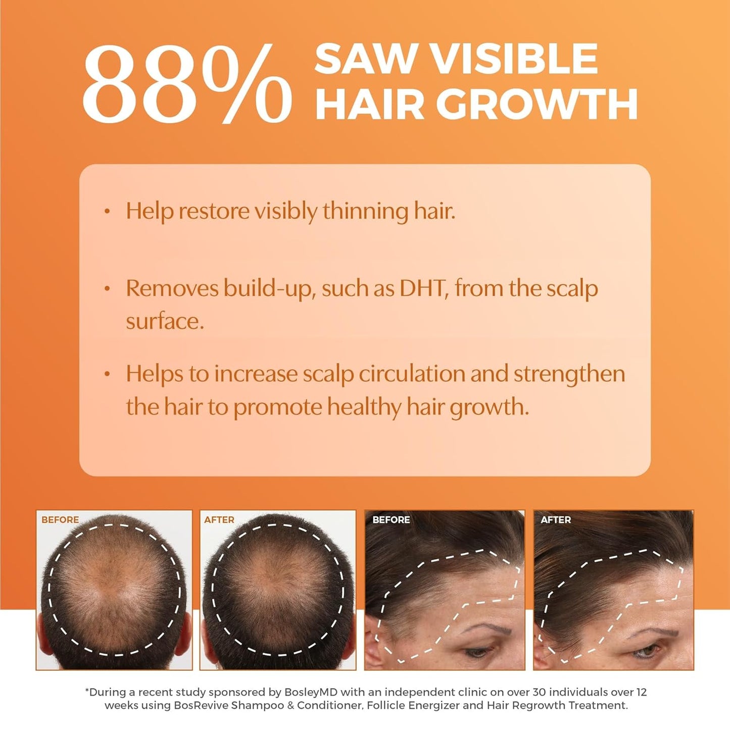 BosRevive Nourishing Shampoo for Thinning Hair - DHT Blocker, Sulfate-Free, Vegan with Biotin & Saw Palmetto | 10.1 Fl Oz