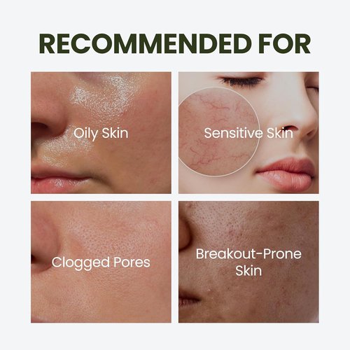 HyCicaMue Defence Cream - Soothing Barrier Repair Moisturizer with Cica & Hyaluronic Acid | Vegan Formula for Sensitive Skin, Sebum Control & Hydration | Korean Skincare