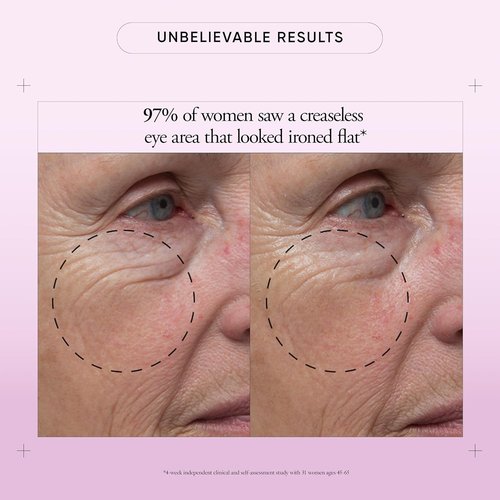 Philosophy Ultimate Miracle Worker Eye Cream - Retinol & Soy Extract for Youthful Skin | 0.5 Fl Oz
