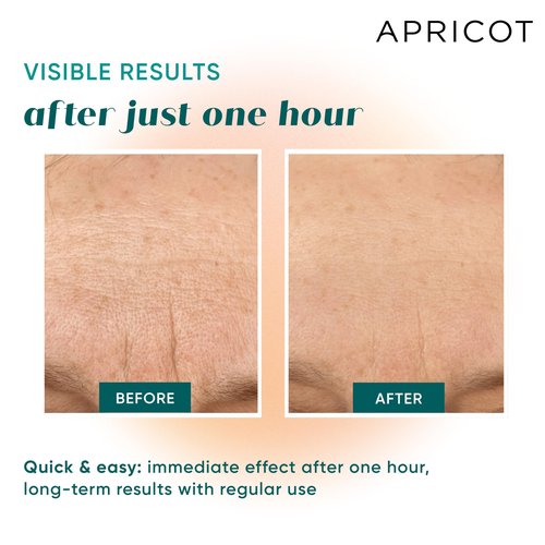 APRICOT Forehead Wrinkle Patches Overnight "Fantastic Forehead" I 30x Reusable I Silicone Pads for Forehead & Frown Lines with Hyaluronic Acid I Silicone Forehead Wrinkle Patches I Made in Germany