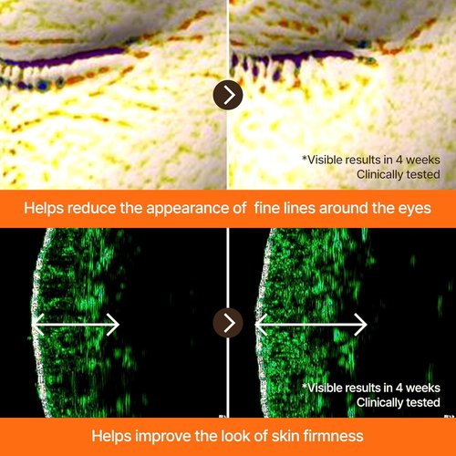 Goodal Black Carrot VITA-A Retinal Intense Serum - Advanced Dark Spot Correcting Glow Formula | 0.68 Fl Oz