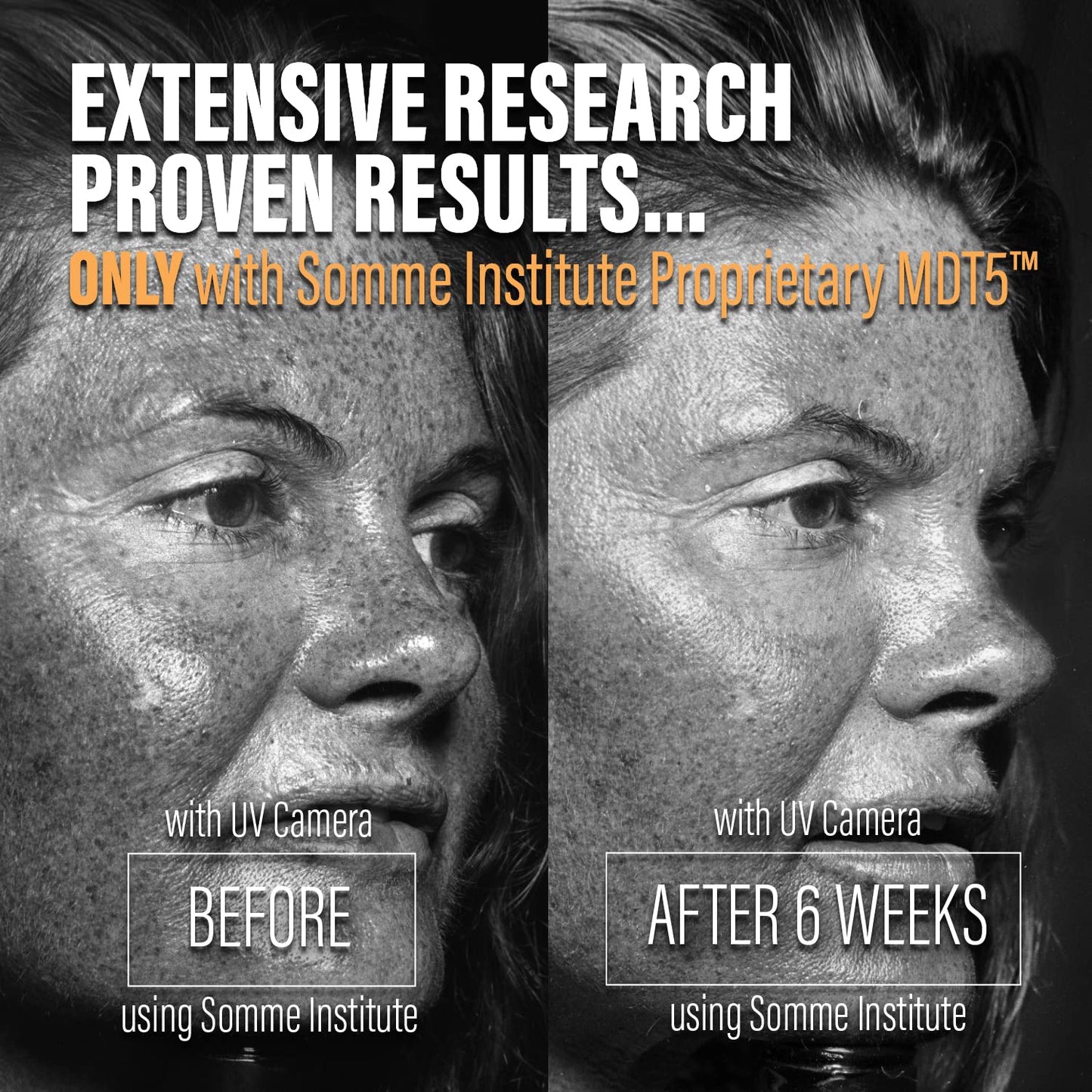 Somme Institute Exfoliating Glycolic Acid Pads - Anti-Aging & Resurfacing | 50 Count