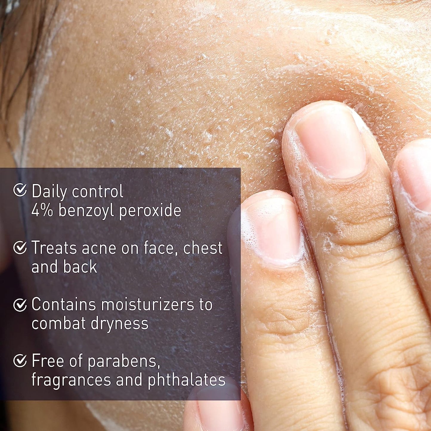 PanOxyl 4 Acne Creamy Wash, 4% Benzoyl Peroxide 6 oz (Pack of 10)