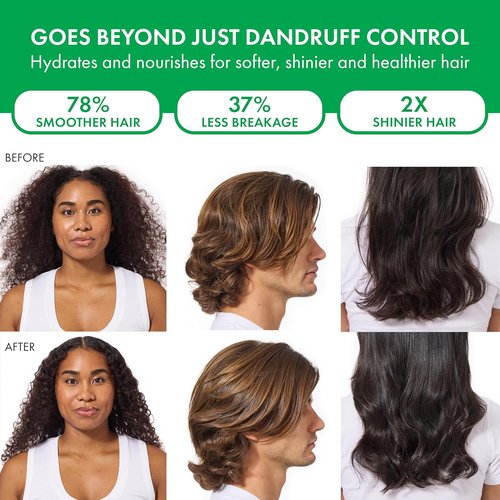 Dercos Dandruff Shampoo - Antifungal Treatment for Dry Scalp Relief | Prescription Strength Selenium Sulfide