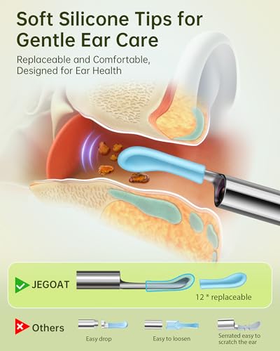 Ear Wax Removal, Ear Cleaner with Camera, Ear Cleaning Kit 1296P HD Ear Scope, 6 LED Lights and 10 Ear Picks, Earwax Removal with Otoscope to Earify Earwax, iOS and Android